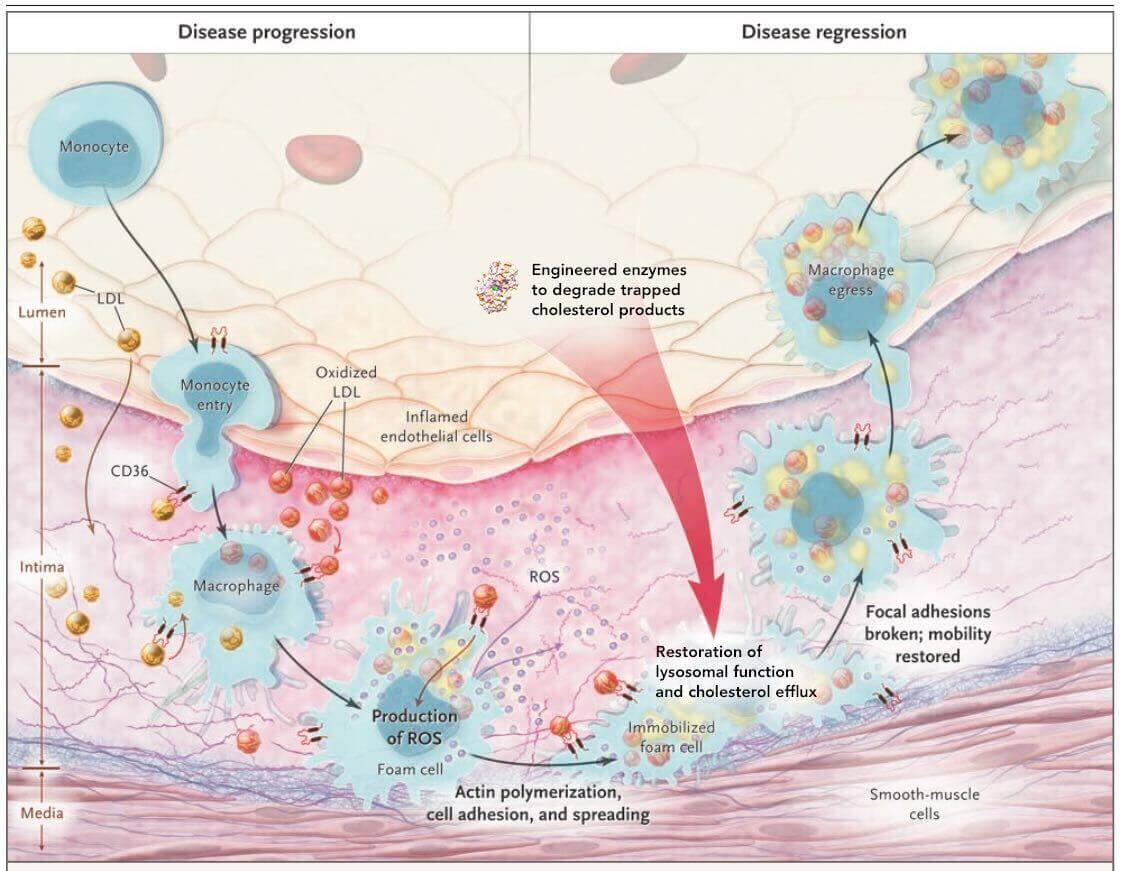 LysoSENS: Clearing Waste Accumulations Out of Cells - SENS Research ...